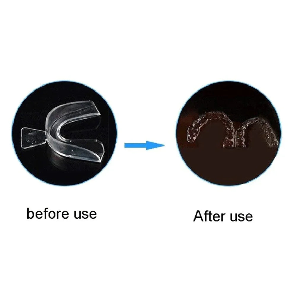 Mouth Guard for Teeth Grinding | Anti Snoring Sleep Aid