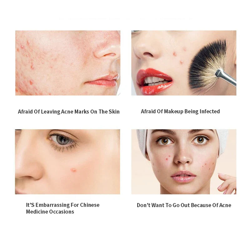 Acne Pimple Patch Invisible Waterproof | Hydrocolloid Spot Treatment for Blemishes