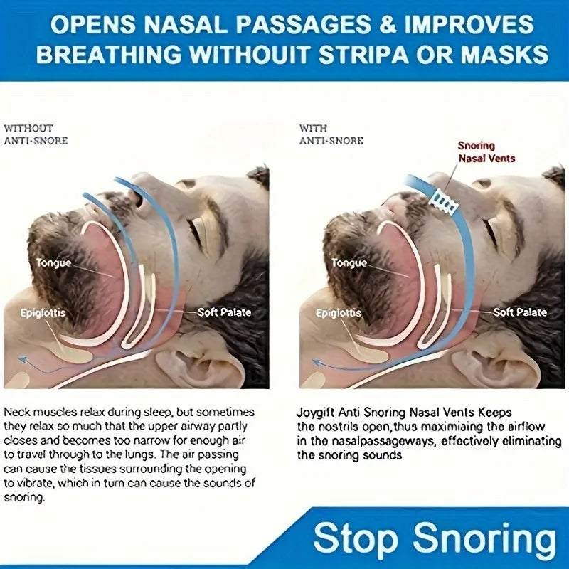 20 Pcs Mini Anti-Snoring Nose Clips | Adhesive Snoring Relief Aid