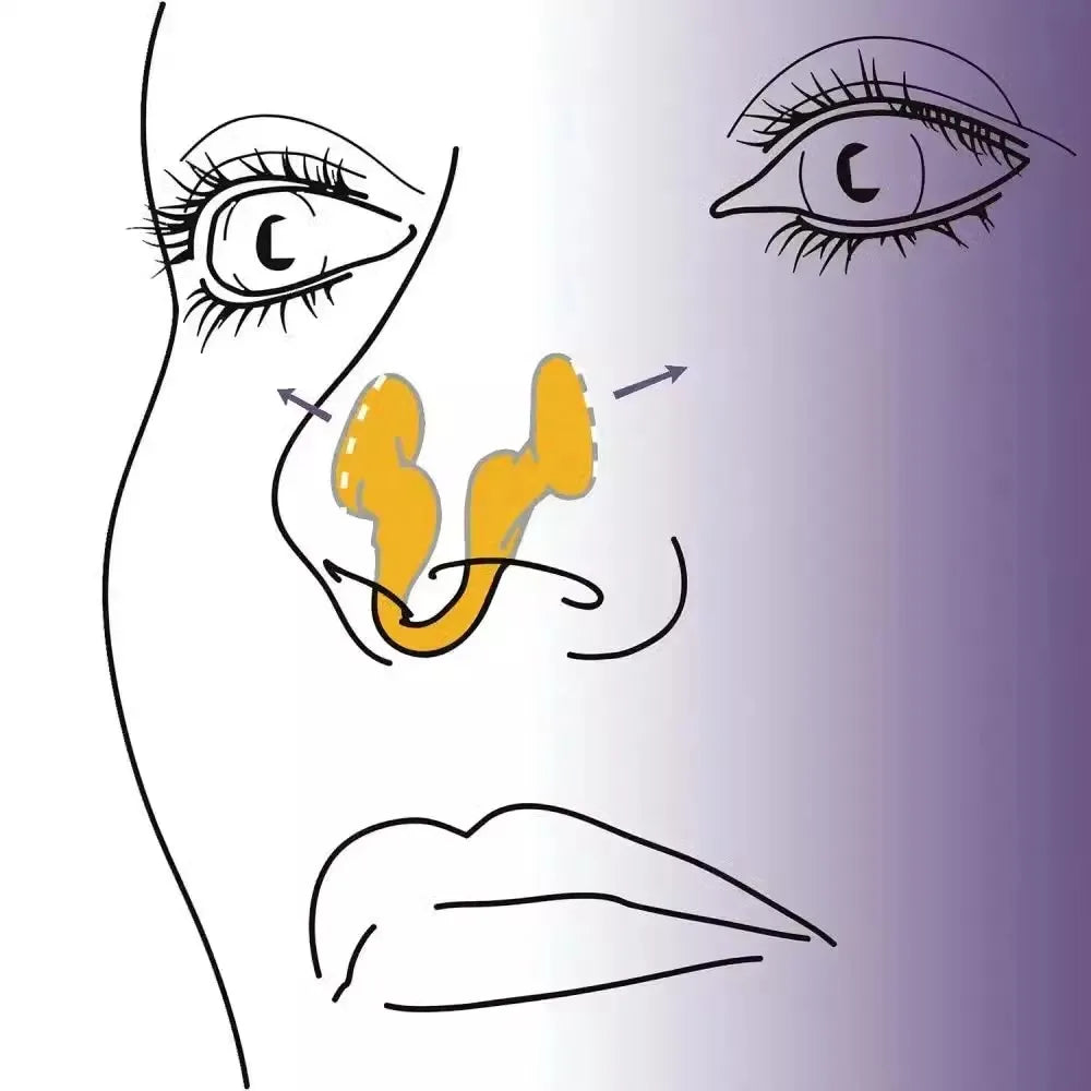 Soft Silicone Anti-Snoring Nasal Dilator | Ease Breathing and Sleep Aid