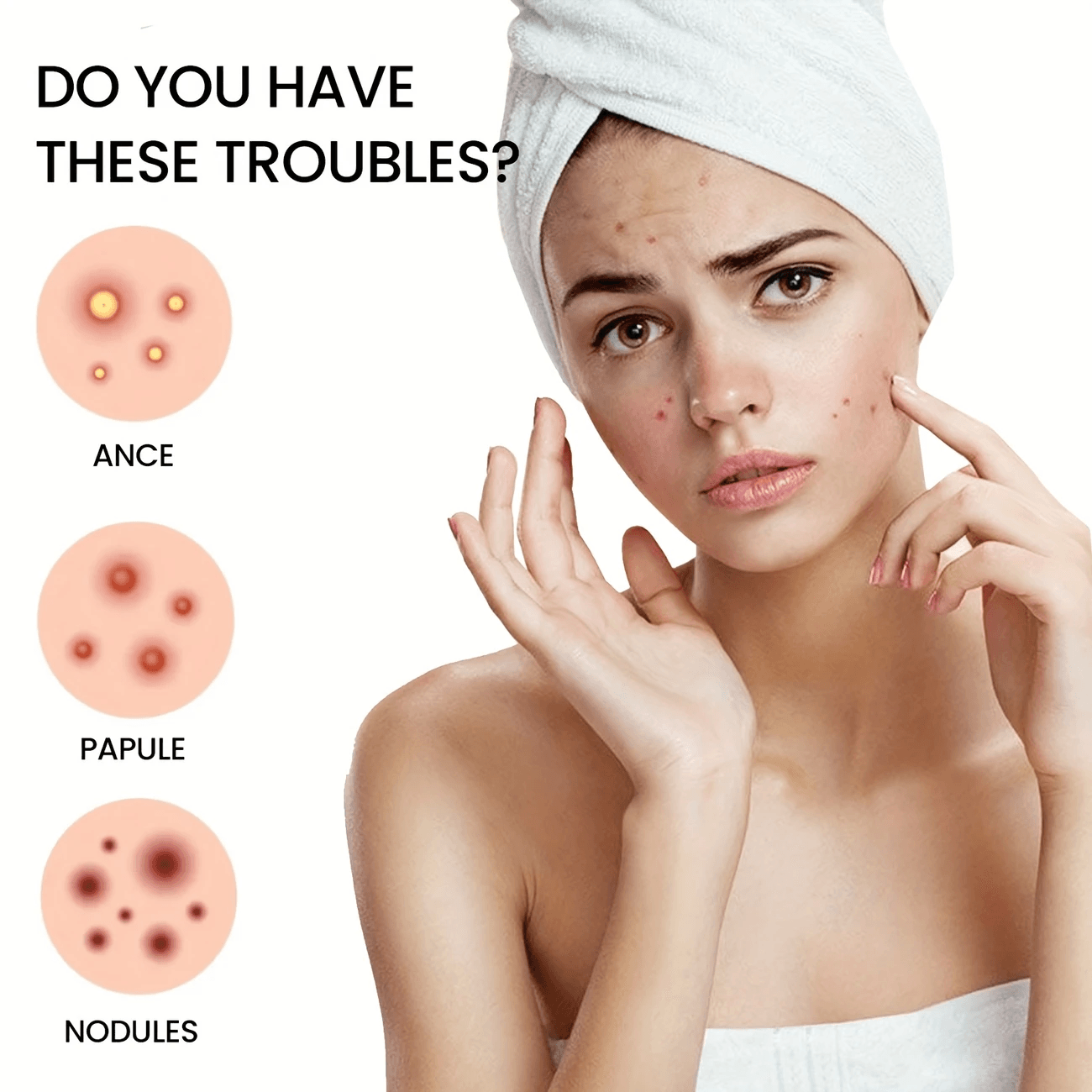 Pimple Patch Acne Dots Heart, Star, Flower & Round Shapes